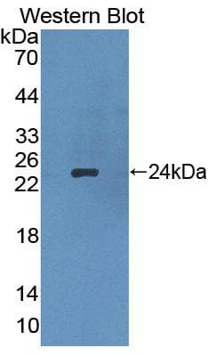 APOB / Apolipoprotein B Antibody (aa3329-3494, PE)