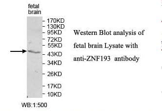 ZNF193 Antibody (aa4-216)