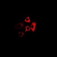 RPL13 / Ribosomal Protein L13 Antibody