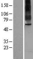 TAS1R2 / T1R2 Protein (Over-Expression Lysate Myc-DDK (Flag))