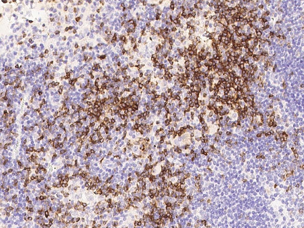 Monoclonal Mouse anti-Human CD7 Antibody (clone 21, Preservative Free, IHC, WB)