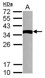Polyclonal Rabbit anti-Human NME9 / TXNDC6 Antibody (IHC, WB)