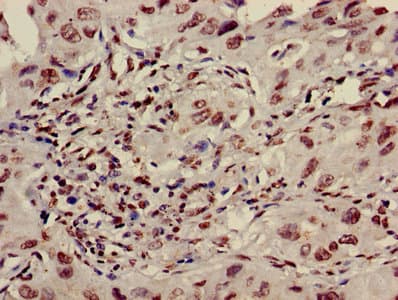 Polyclonal Rabbit anti-Human HIST1H3A Antibody (IHC, IF)