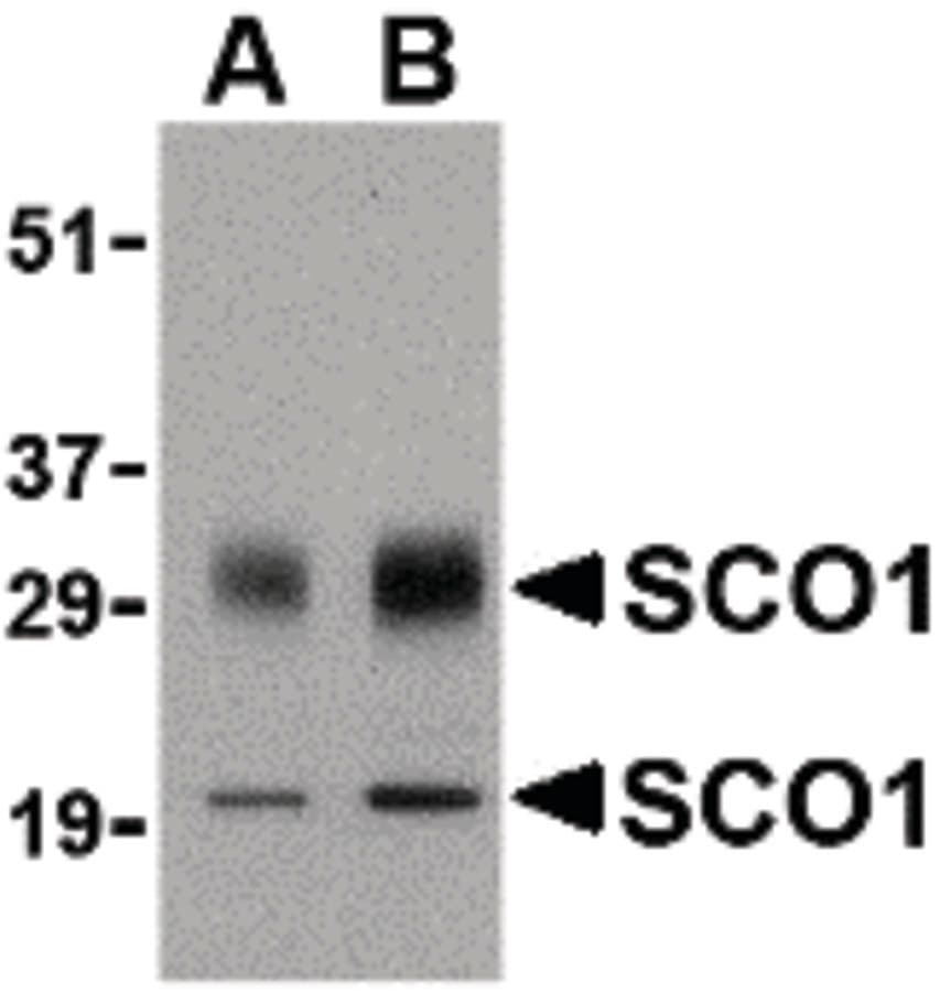 IHC-plus™ Polyclonal Rabbit anti-Human SCO1 Antibody (IHC, IF, WB)