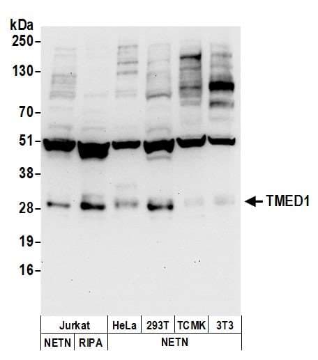 TMED1 / ST2L Antibody (aa50-100)