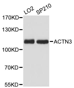 Polyclonal Rabbit anti-Human ACTN3 Antibody (IF, WB)