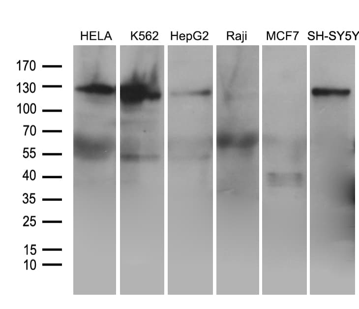 Monoclonal Mouse anti-Human ROR2 Antibody (clone OTI4B10, aa796-927, IHC, WB)