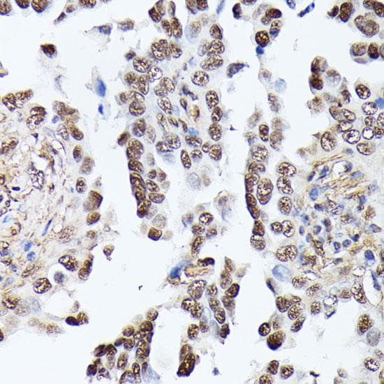 TPI1 / TPI Antibody