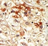 CDK17 / PCTK2 / PCTAIRE2 Antibody (aa47-77)