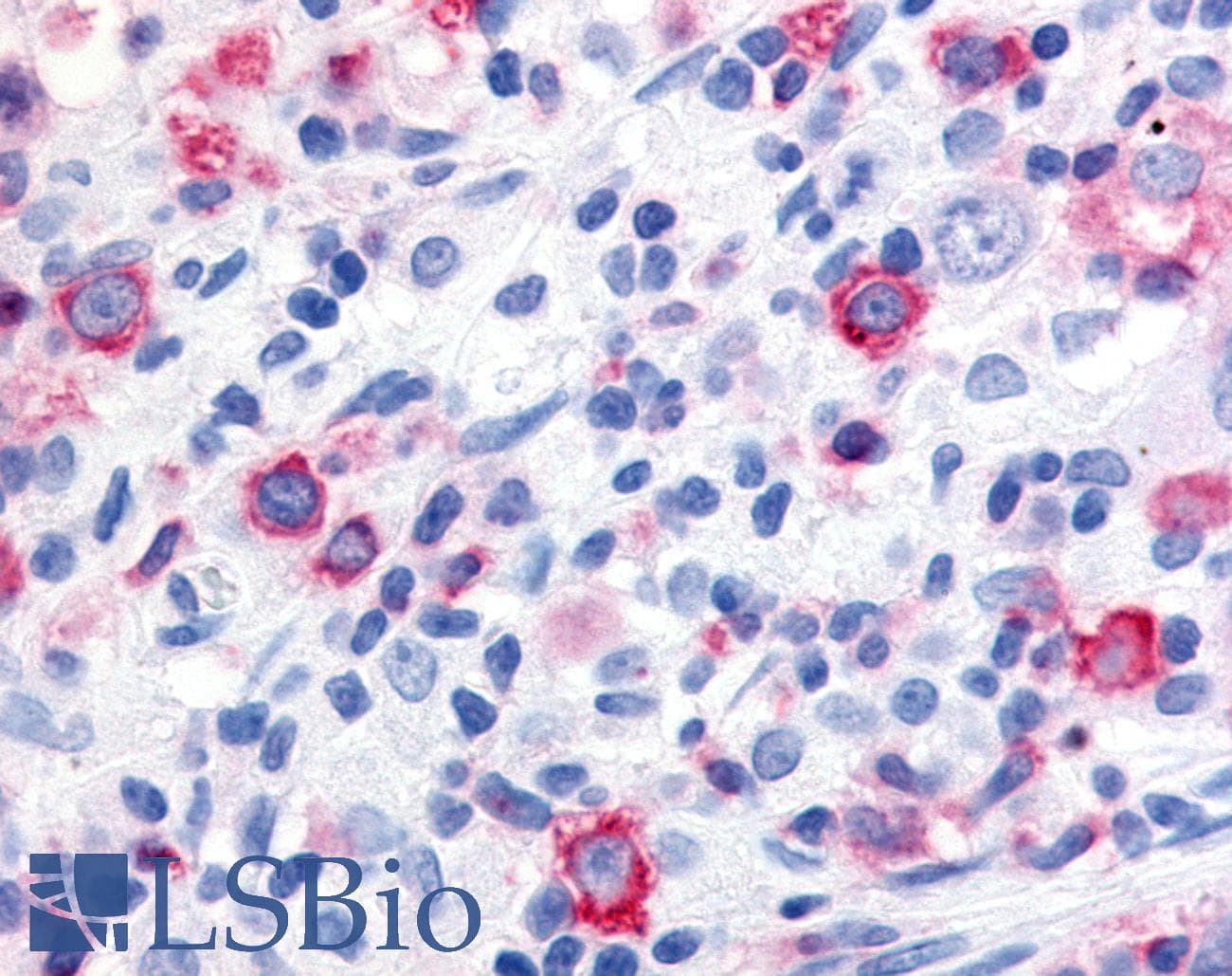 PathPlus™ Polyclonal Rabbit anti-Human WNT10A Antibody (Internal, IHC)