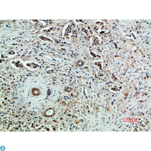 KDR / VEGFR2 / FLK1 Antibody