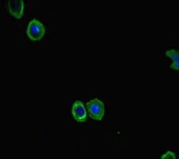 FBXL21 Antibody