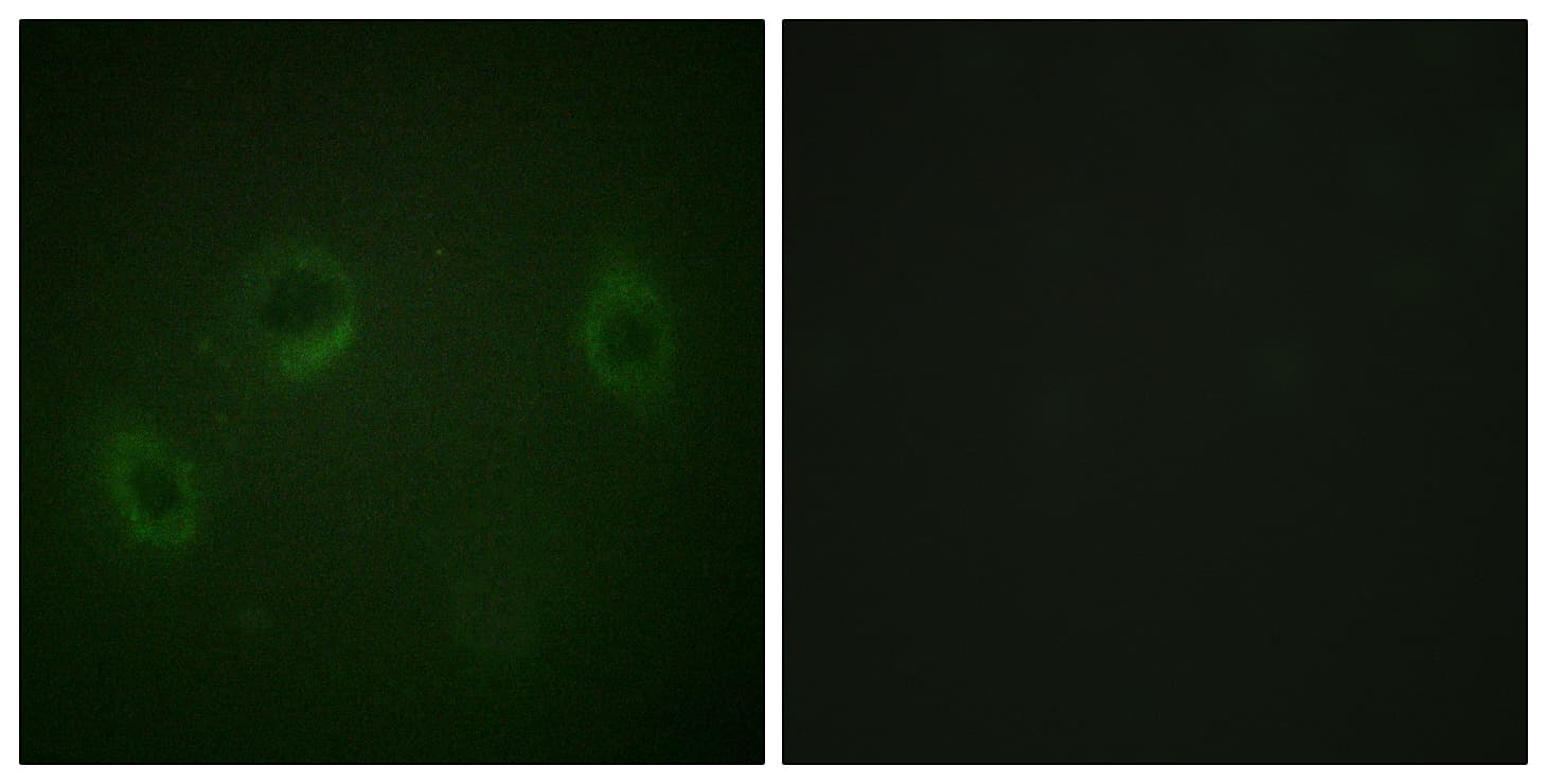 IHC-plus™ Polyclonal Rabbit anti-Human MARK1+2+3+4 Antibody (aa181-230, IHC, IF, WB)