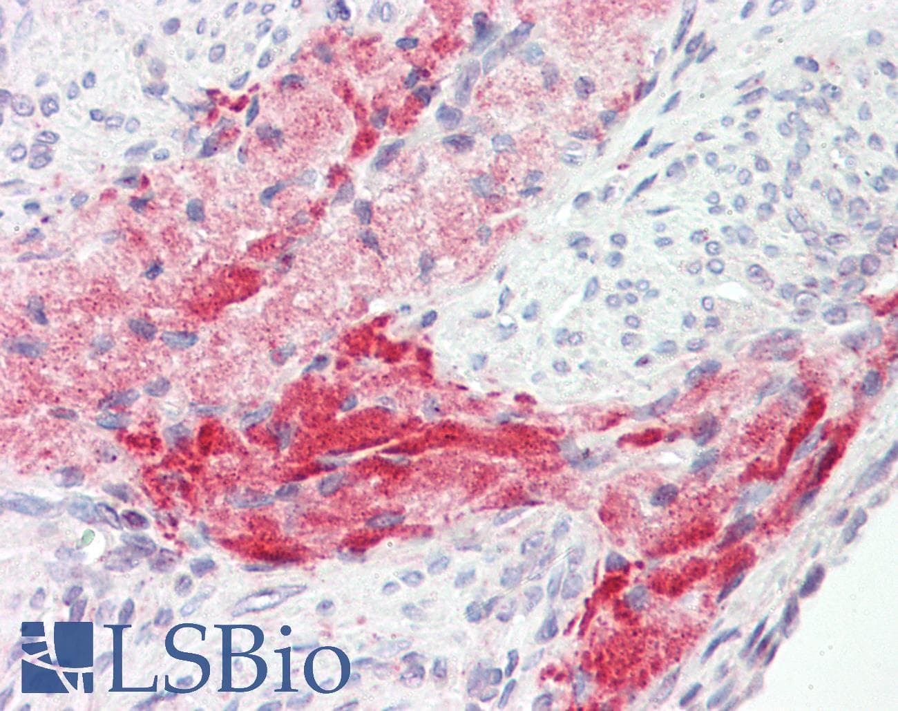 PathPlus™ Polyclonal Rabbit anti-Human TNC / Tenascin C Antibody (C-Terminus, IHC)