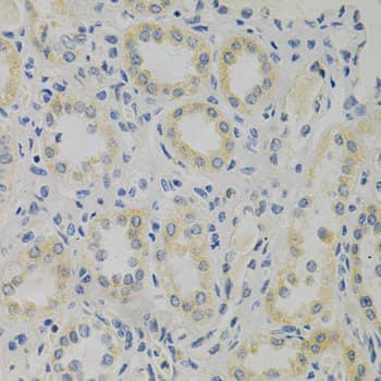 STMN1 / Stathmin / LAG Antibody