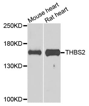 THBS2 / Thrombospondin 2 Antibody