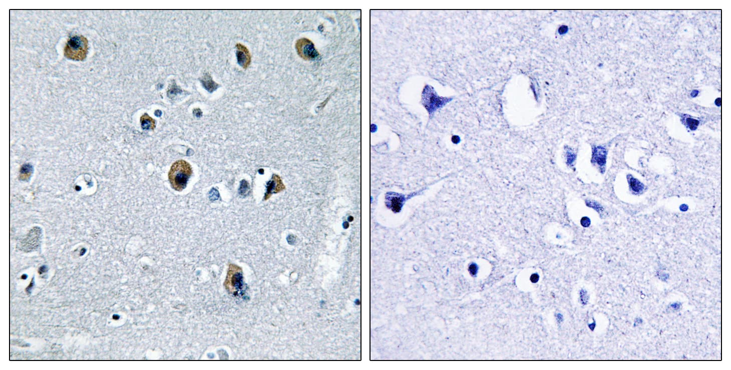 Polyclonal Rabbit anti-Human COL20A1 / Collagen XX Antibody (aa1151-1200, IHC, IF, WB)