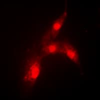 Polyclonal Rabbit anti-Human MDM2 Antibody (phospho-Ser166, IHC, IF, WB)