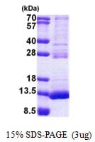 Human TSTD3 Protein (Recombinant His)