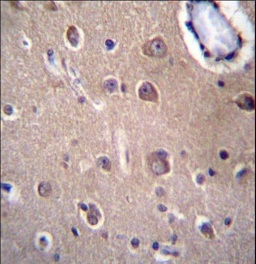 SLC8A3 / NCX3 Antibody (aa585-614)