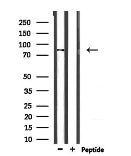 Polyclonal Rabbit anti-Human PPP1R9B / Spinophilin Antibody (IHC, WB)