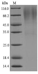 Lysobacter enzymogenes Lys-C Protein (Recombinant 6His, N-terminus)