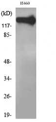 NCAM / CD56 Antibody (aa241-290)