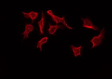 PAWR / PAR4 Antibody