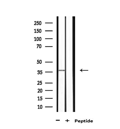 ERCC1 Antibody