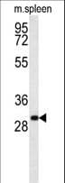 RTP1 Antibody (aa161-189)