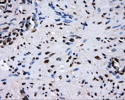 Monoclonal Mouse anti-Human RIP1 / RALBP1 Antibody (clone OTI11B2, IHC, IF, WB)