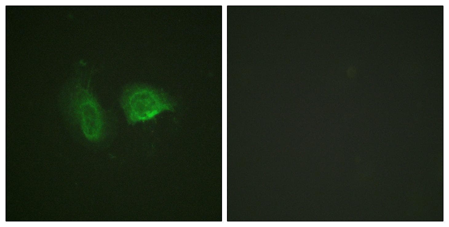 CASR/Calcium Sensing Receptor Antibody (phospho-Thr888)