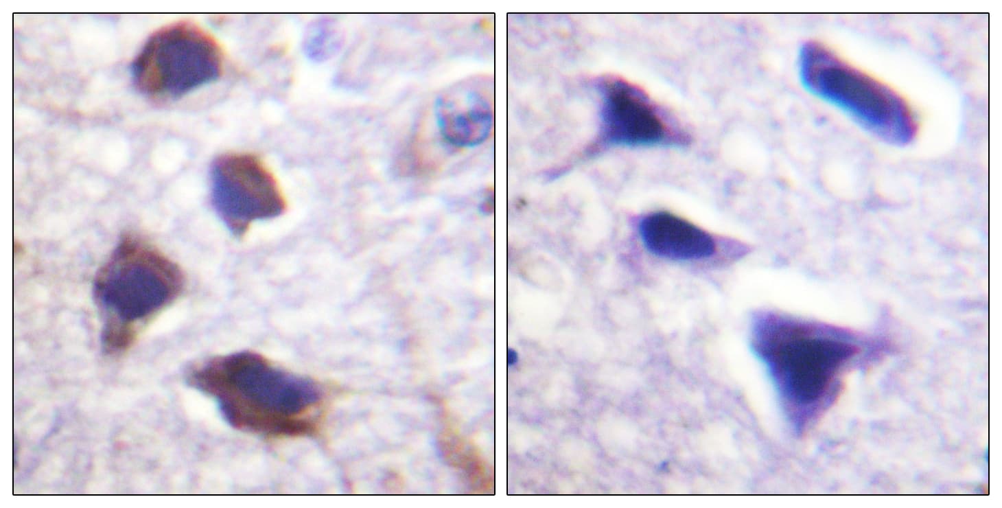 ADRB2 Antibody (aa321-370)