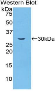 SGK3 Antibody (aa141-368)