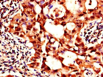 SIK1 / MSK Antibody