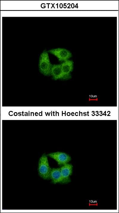 PCCB Antibody (aa167-480)