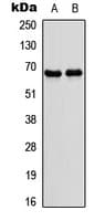 Nor-1 / NR4A3 Antibody (Internal)