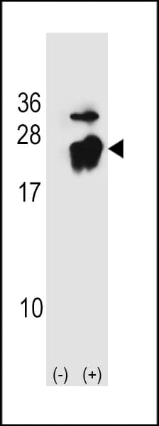 PEBP1 / RKIP Antibody (aa137-167)