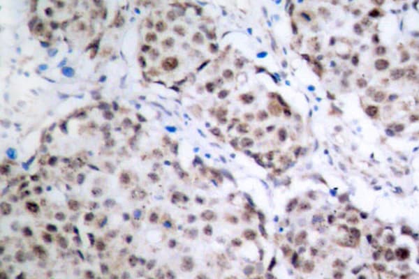 Polyclonal Rabbit anti-Human TP53 / p53 Antibody (phospho-Ser315, IHC, WB)