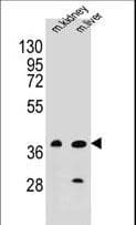 BRUNOL6 / CELF6 Antibody (aa46-74)