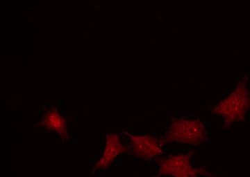 Polyclonal Rabbit anti-Human NBN / Nibrin Antibody (phospho-Ser343, IF, WB)