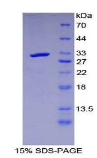 Mouse LRIG3 Protein (Recombinant His-T7)