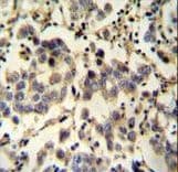 C6orf58 Antibody (aa205-233)