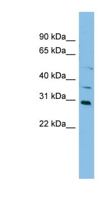 NAT2 Antibody (C-Terminus)