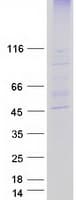 Human ZDHHC2 Protein (Recombinant Myc-DDK (Flag))