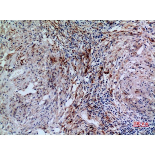 HSD17B4 Antibody (N-Terminal)