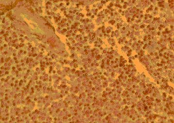 CCR4 Antibody (aa17-39)