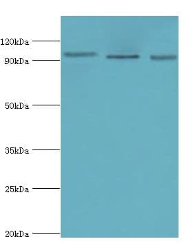 Polyclonal Rabbit anti-Human CLOCK Antibody (aa577-846, IHC, WB)