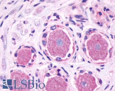 PathPlus™ Polyclonal Rabbit anti-Human MRGPRE / MRGE Antibody (C-Terminus, IHC)