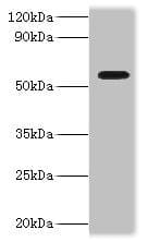 IHC-plus™ DDX19A Antibody (aa1-478)